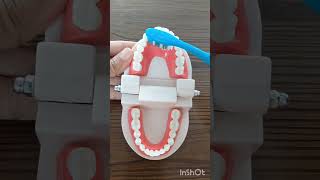 brushing technique#apki dentist#brushing#how to brush your teeth