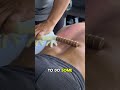 Knot Infested Lower Back Knot Infested Lower Back