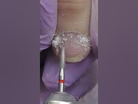 Обгрызенные Ногти - Преображение - YouTube