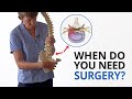 Disc herniation when do you need surgery plus fixing the root cause