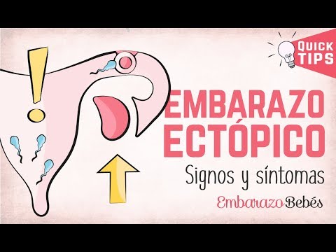 Vídeo: Signos De Un Embarazo Ectópico