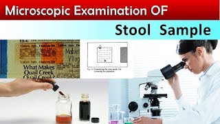 Stool Microscopic Examination  ( Clear & 100% Correct Method )
