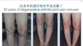 Ageloc R2 Before & After Testimonial