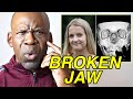 Emily eccles injury broken jaw explained by orthopedic surgeon dr chris raynor