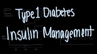 Insulin Management of Type 1 Diabetes