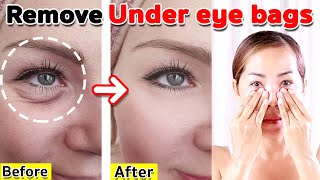 Remove under eyes bags | NO TALKING | Facial Massage