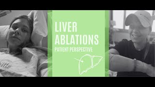 What is an ablation of the liver like? (microwave ablation)