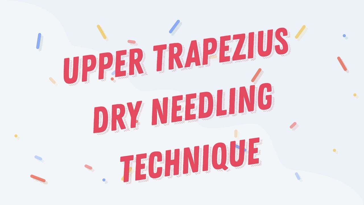 Dry Needling Technique Upper Trapezius Trigger Point (Headache, neck