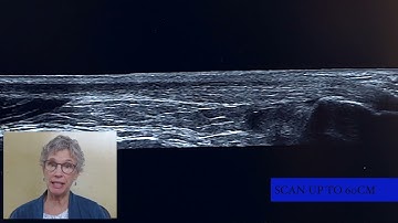 Introducing Venue™ View on Venue Family POCUS