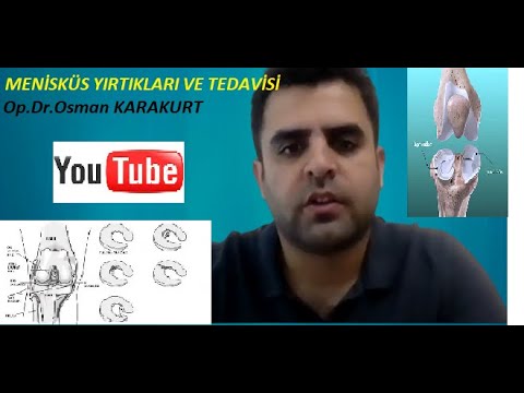 ✅Menisküs Yırtığı ve Tedavisi 🟢 Ameliyat ve MR görüntüleriyle menisküs yırtıkları