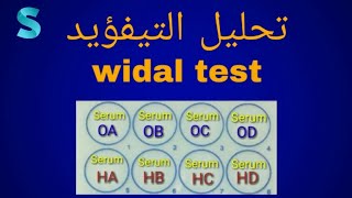 تحليل تيفؤيد  widal test