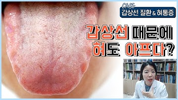 갑상선기능저하증 갑상선기능항진증 있을 때 혀가 더 아픈 이유