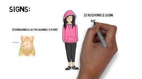 Appendicitis & its symptoms, signs, examination , investigation and general and specific treatment