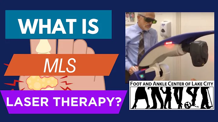 What You Need To Know About MLS Laser Therapy