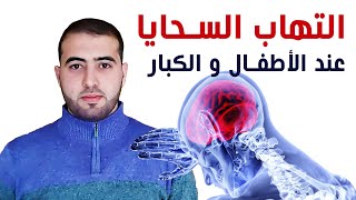 التهاب السحايا عند الكبار / الأطفال/ حديثي الولادة - الأعراض والمضاعفات / العلاج و الوقاية