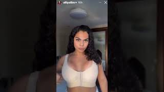 90 Day Fiance: Alliya Debuts New Breast Implants! #90dayfiance