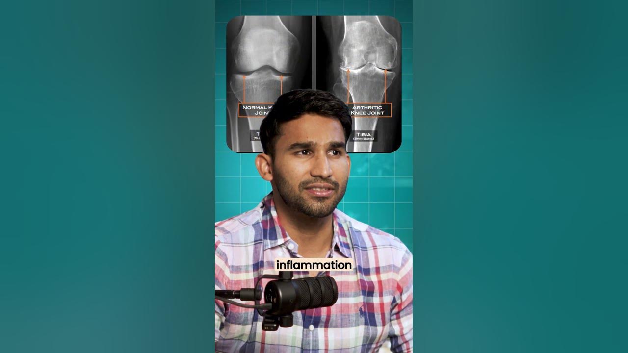 what-does-osteoarthritis-mean-youtube