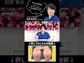 【たるみ除去】Aスレッドの特徴 #aclinic #美容 #糸リフト #shorts #aスレッド