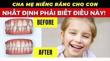 "Niềng Răng Nhất Định Phải Biết Điều Này: Bí Quyết Để Có Nụ Cười Hoàn Hảo!" | Dr Cường Official