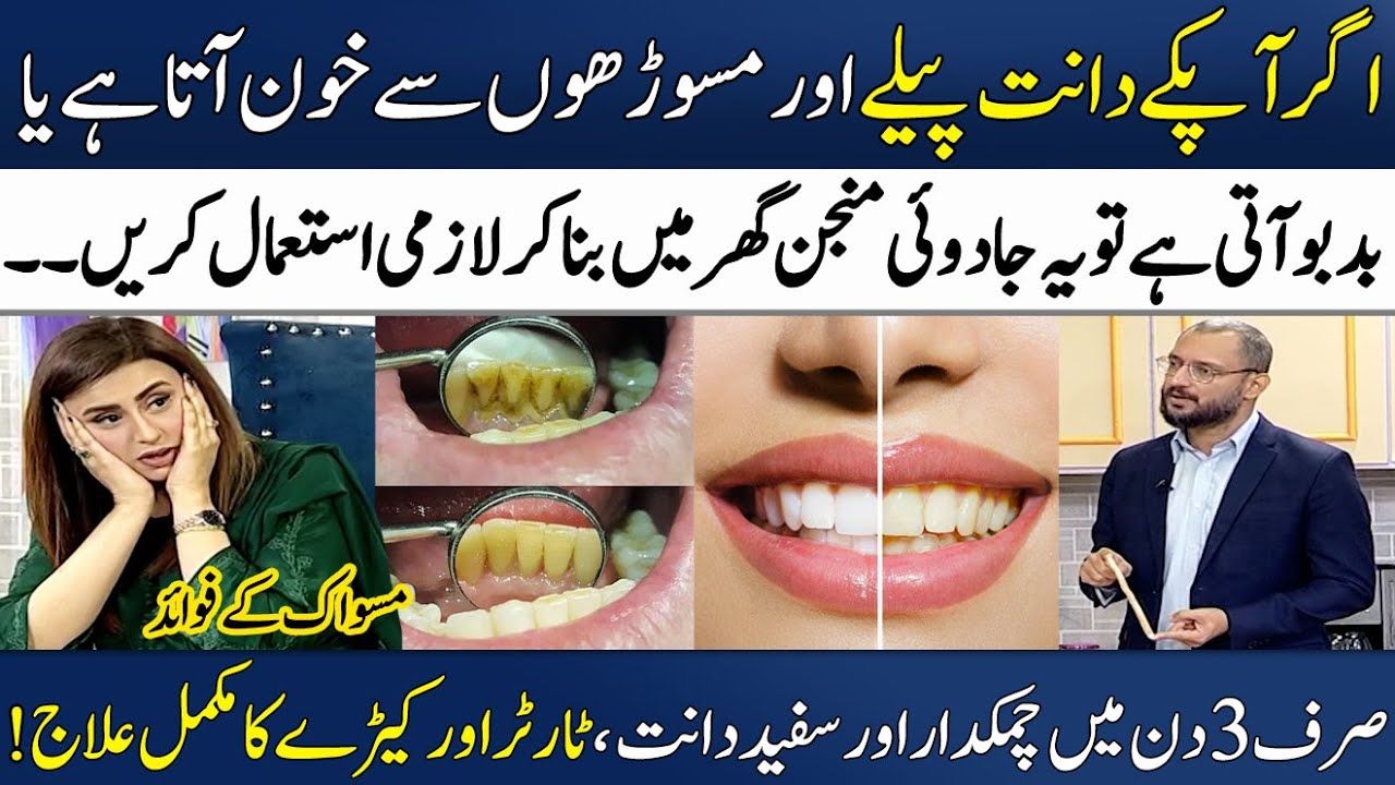 Natural Way to Whiten Your Teeth🦷 | Danton Say Tartar Ka Khatma! | Ghalib Agha | Madeha Naqvi