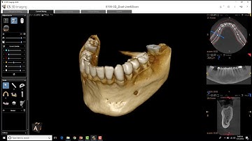 Carestream 3D Imaging - Region of Interest Tools