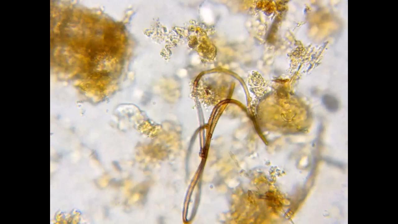 Fungi Clamp Connection - YouTube