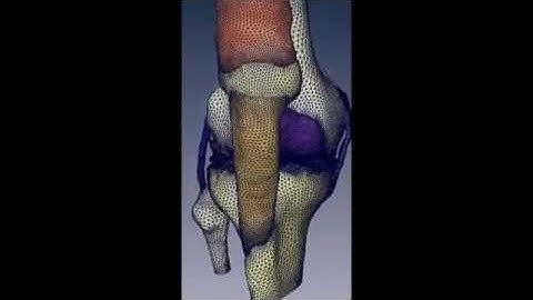 3D Computational Modeling of the Human Knee in Physiological State