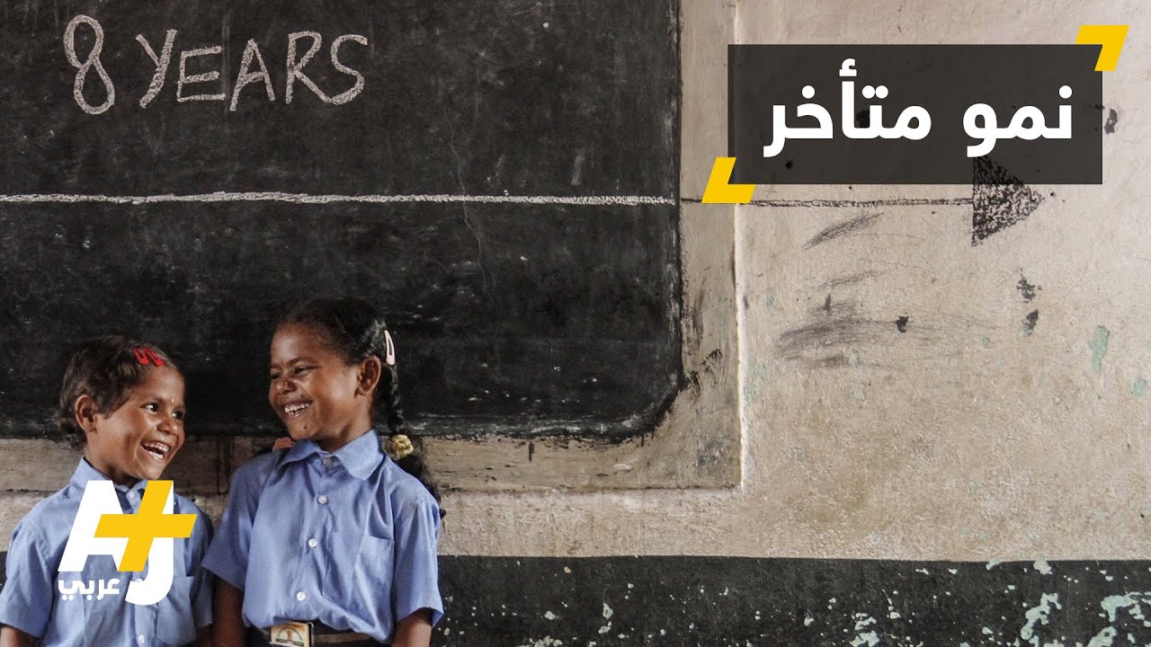 نقص النمو يهدد أطفال العالم