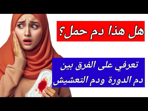 هل دم انغراس البويضة ينزل في موعد الدورة كيف تعرفين انك حامل وما الفرق بين دم الدورة ودم التعشيش