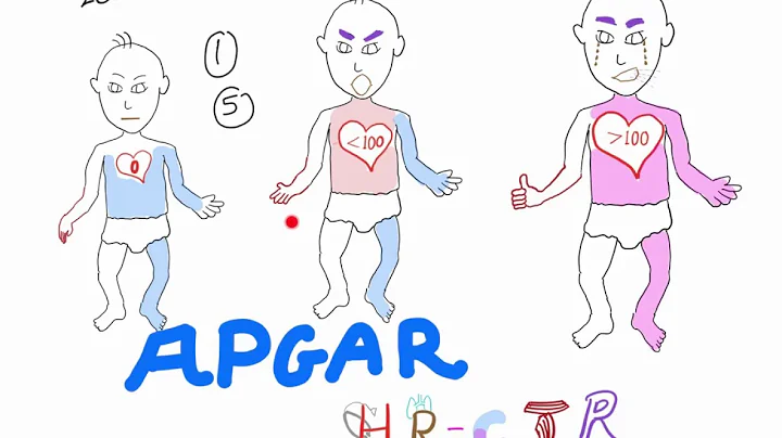 Understanding APGAR score, the best explanation wi...