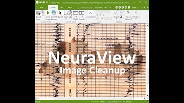 NeuraView Image Cleanup for Scanned TIFF Logs