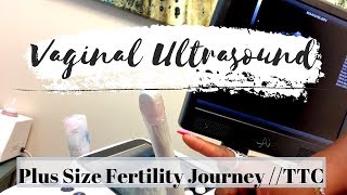 MORE RESULTS Vaginal Ultrasound \/\/ Plus Size Fertility Journey \/\/ TTC