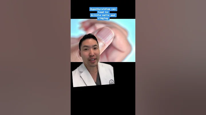 Causes for Vertical Nail Ridges and Lines