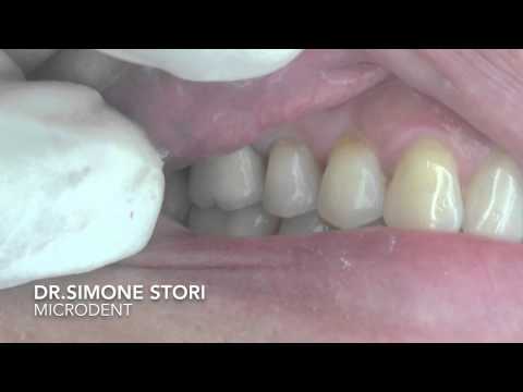 Video: 3 modi per fare il dentifricio