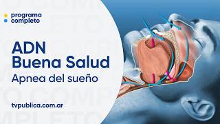 ¿Qué son las apneas y cómo prevenirlas? - ADN Buena Salud