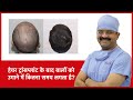 How long it takes for hair to grow after hair transplant  hairmd pune  in hindi