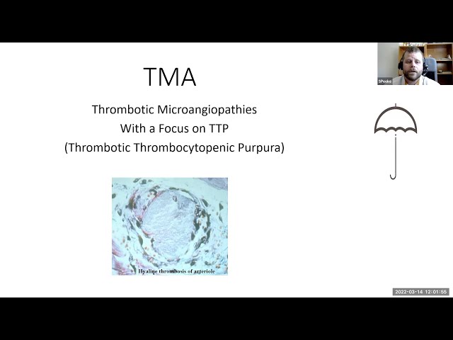 Thrombotic Microangiopathies with a Focus on TTP (Thrombotic Thrombocytopenic Purpura)