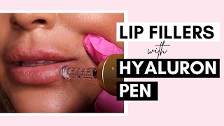 No Needle Lip Filler With Hyaluron Pen | Procedure And Aftercare Ft @SaigeWellington by Viana Care 90,953 views 2 years ago 13 minutes, 11 seconds