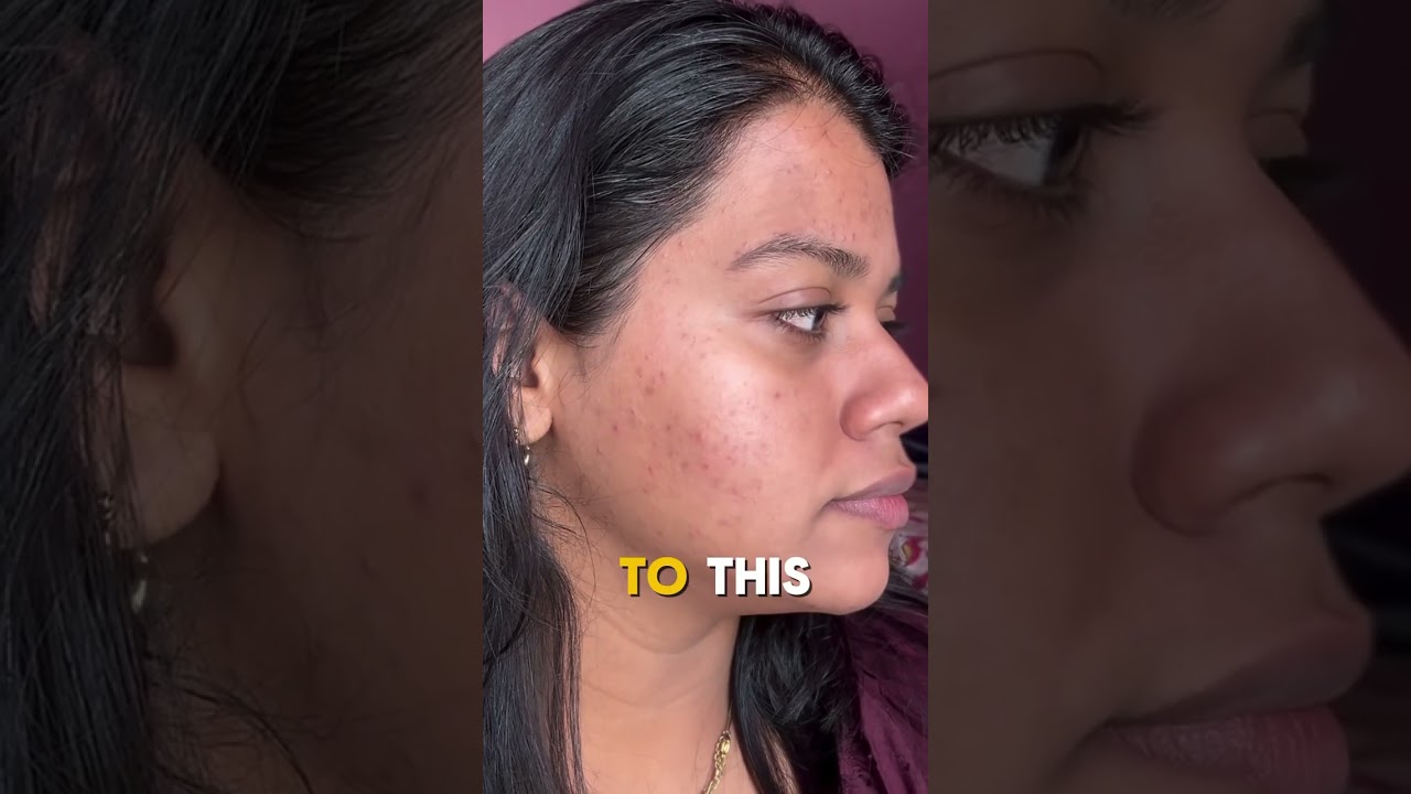 ✨This dermatologist-approved cream changed my skin game ⏩Curious about my secret? Comment “LINK”