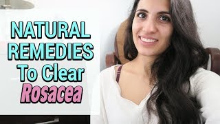 Natural remedies for eliminating rosacea | holistic tips