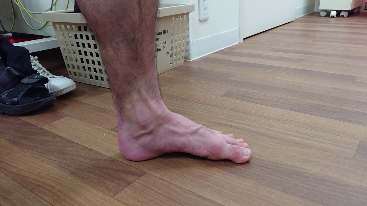 足をケガしてるときのリハビリ 4 足を骨折したプロダンサー 第５中足骨基底部骨折 足指を伸ばす 這わす 伸ばして引き寄せる