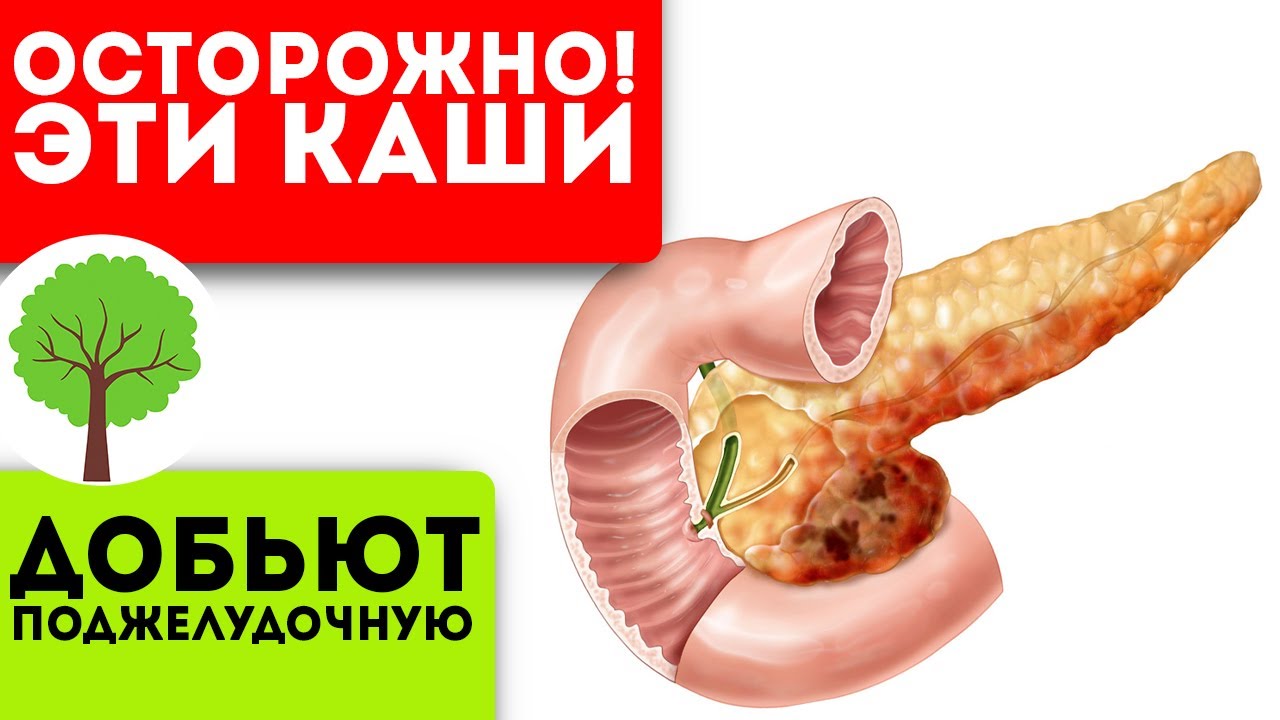 Даже врачи делают эту ошибку! При панкреатите ни в коем случае не ешьте эти каши, иначе …