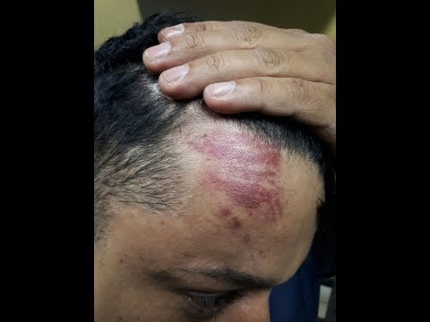Mototaxista é agredido em roubo na Avenida São Paulo