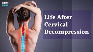 Life After Cervical Decompression