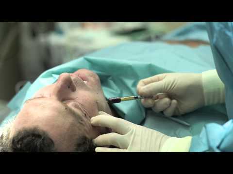 Video: Vijf Centimeter Huid Verwijderd Van Gezicht Van Liefhebber Van Plastische Chirurgie