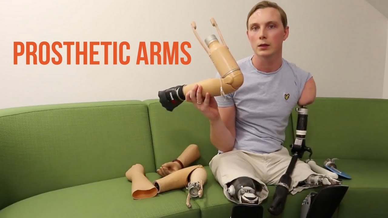 Amputee Prosthetic Arm