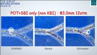 The Great Bifurcation Debate (Yutaka Hikichi)