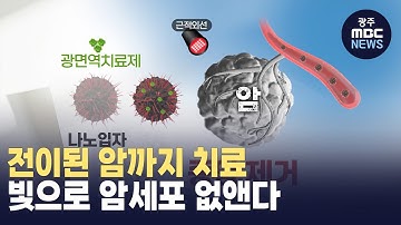 전대*과기원 공동으로 암세포 죽이는 광면역치료제 개발 (뉴스데스크 2024.3.7 광주MBC)