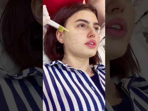 Qısa video — Dr. Mehdi Mahmudi