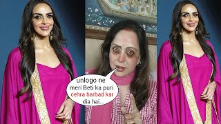 Hema Malini&#39;s shocking statement on Esha Deol after her worst Plastic Surgery Gone Wrong